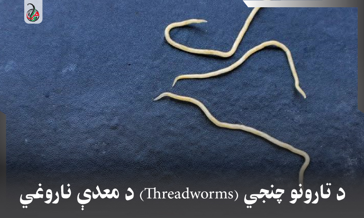 د تارونو چنجي (Threadworms) د معدې ناروغي