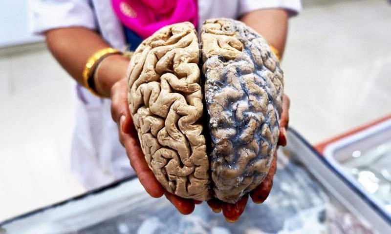 څیړنه: د هندیانو ذهنونه په نړۍ کې ترټولو کوچني دي   