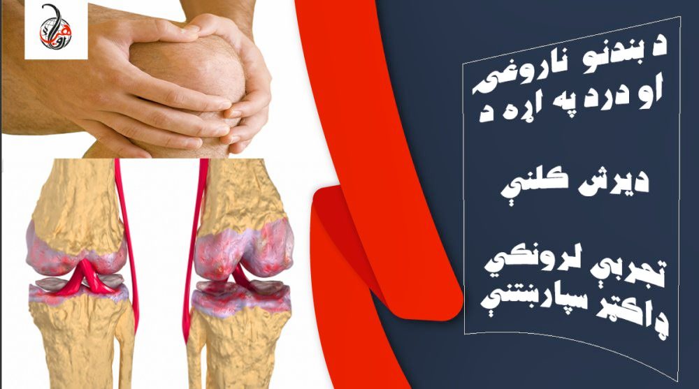 د بندونو ناروغۍ او درد په اړه د ديرش کلنې تجربې لرونکي ډاکټر سپارښتنې 