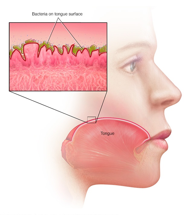 Halitosis يا د خولې بد بوی او درملنه يې